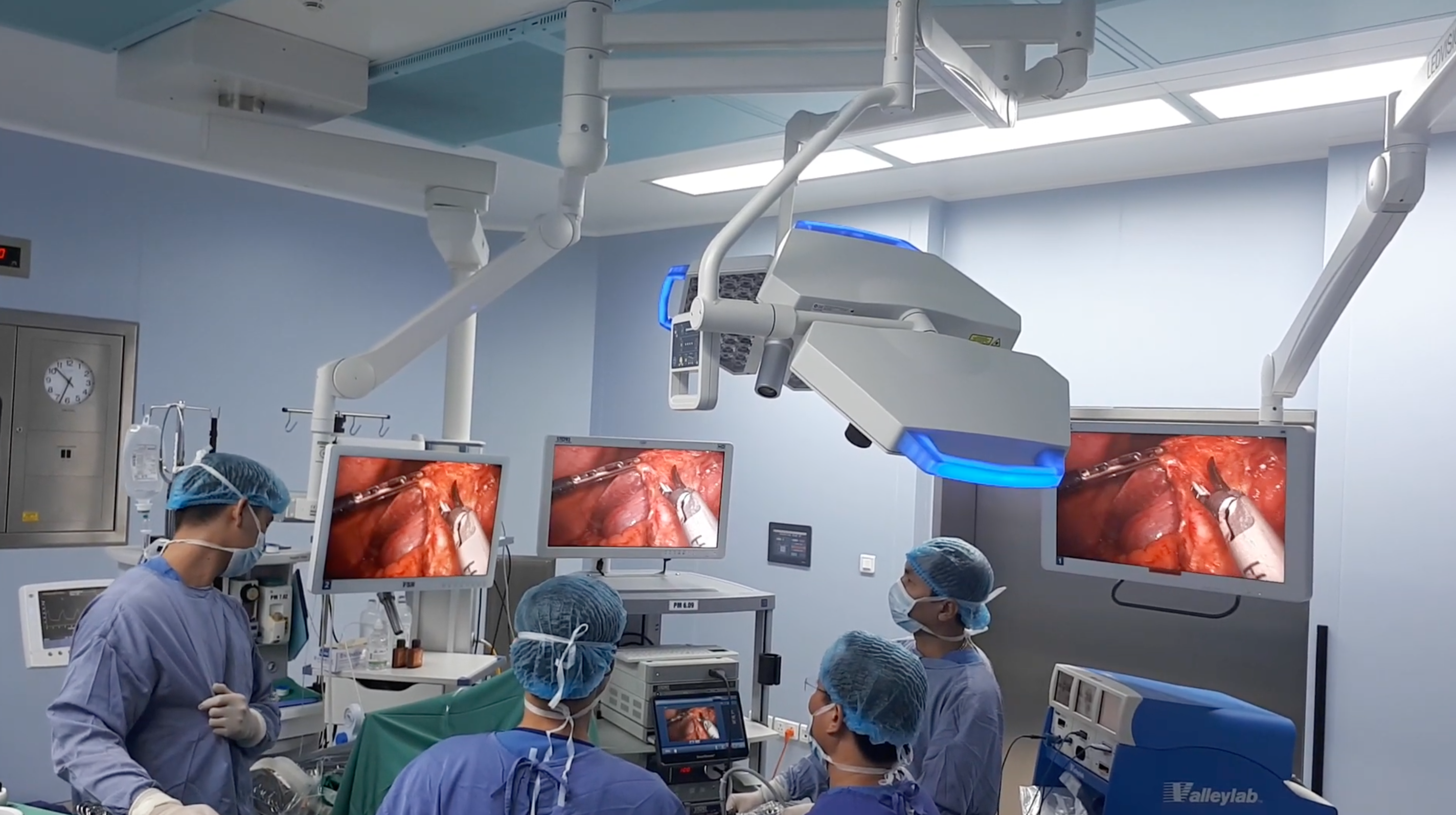 Ekíp phẫu thuật PTNS Giảm Mỡ nội soi Dr. Phan Sử