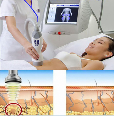 Sieu am danh gia lớp mo, pin giảm mo – Dr. Phansu, NS khau co bung, www.ptnsgiammo.vn Sieu am danh gia lớp mo, pin giảm mo - Dr. Phansu, NS khau co bung, www.ptnsgiammo.vn