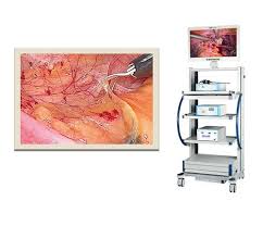  Chỉ có Nội Soi giảm mỡ mới thực hiện được NS Khâu Cơ